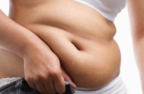 Жир на животі. Як позбутися жиру на животі. Причини появи жиру на животі