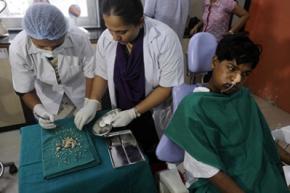 Хірурги видалили індійському підлітку 232 зуба