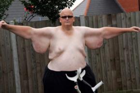 Житель Великобританії схуд на 305 кілограмів заради коханої