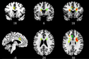 Ученые определили воздействие любви на мозг