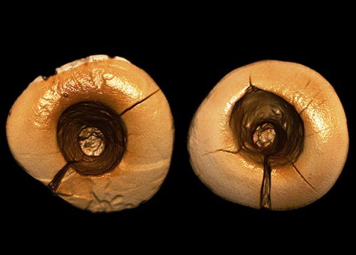 Археологи знайшли зубні пломби віком 13 тисяч років